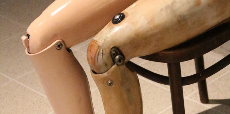 Proteza podudzia - kiedy jest stosowana i gdzie ją kupić?