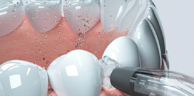 Irygator do zębów - do czego służy i czy warto go kupić?