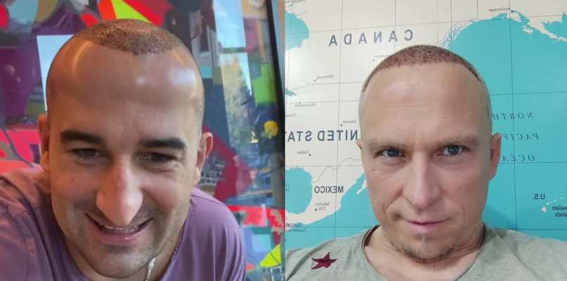 Wokalista Talismana jak Misiek Koterski. Będą mieli włosy jak turecki dywan