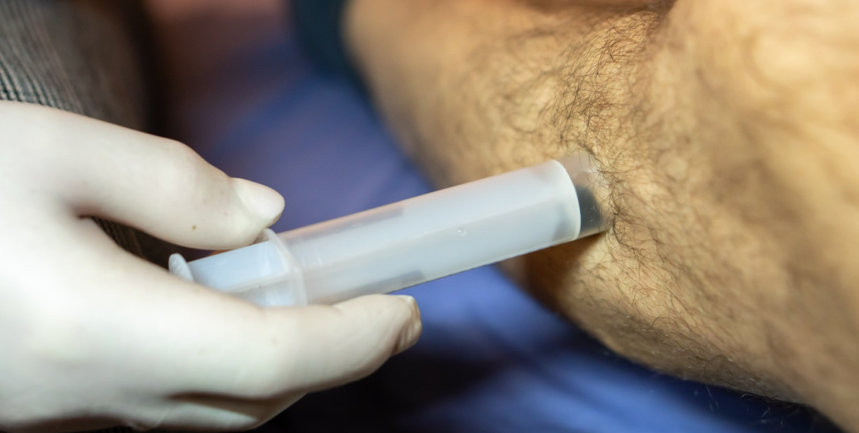 Hirudoterapia a fizjoterapia – zastosowanie pijawek